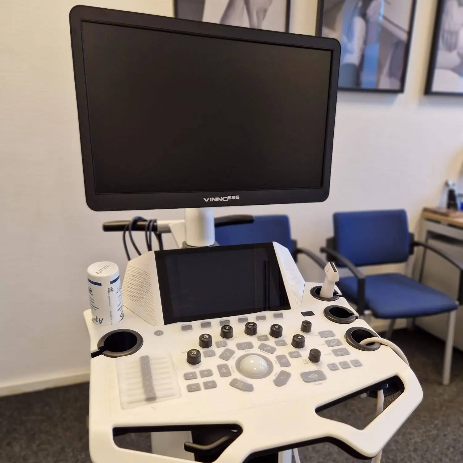 Echografie